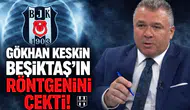 Gökhan Keskin Beşiktaş’ın röntgenini çekti!