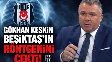 Gökhan Keskin Beşiktaş’ın röntgenini çekti!
