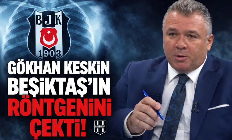 Gökhan Keskin Beşiktaş’ın röntgenini çekti!